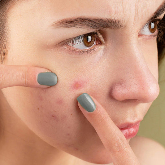 Pimples in the woman face